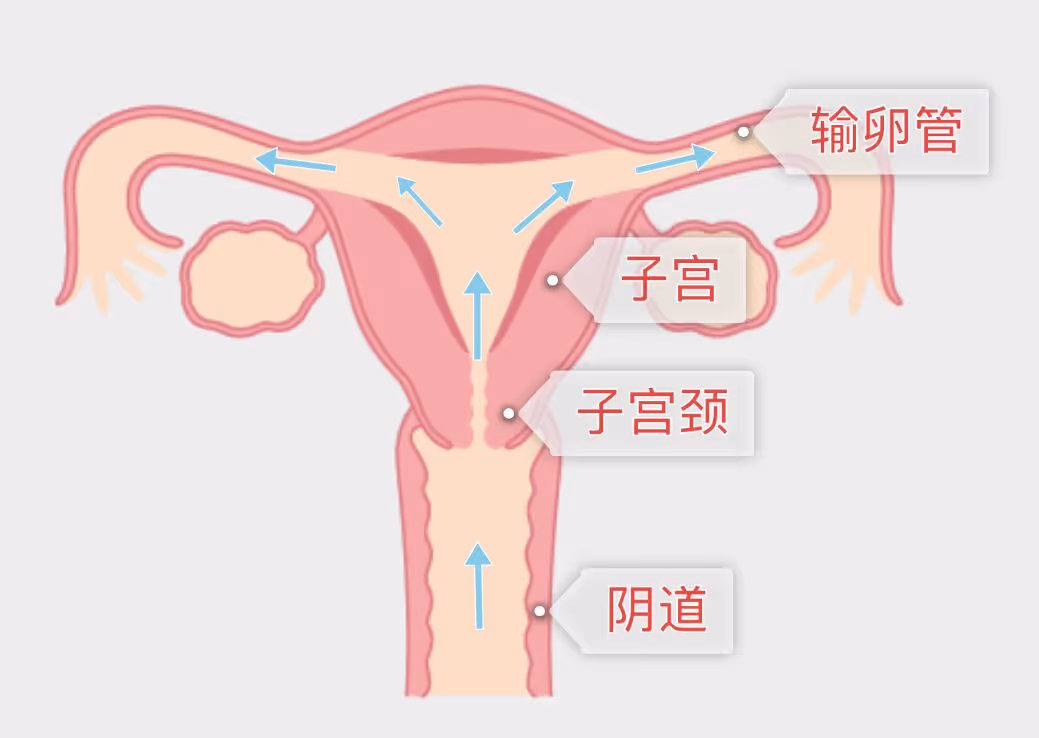 图 1 精子行进方向,途经阴道 — 子宫颈 — 子宫 — 输卵管